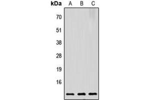 Western blot analysis of Prothymosin alpha expression in HeLa (A), Raw264. (PTMA anticorps  (C-Term))
