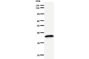 Western Blotting (WB) image for anti-Mediator Complex Subunit 26 (MED26) antibody (ABIN931047)