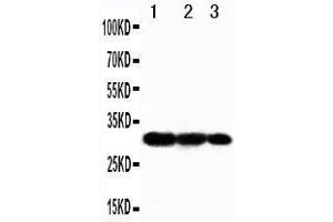 Western Blotting (WB) image for anti-TNF Receptor-Associated Factor 3 (TRAF3) (AA 387-403), (Middle Region) antibody (ABIN3042952) (TRAF3 anticorps  (Middle Region))
