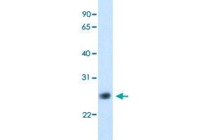 Western Blot analysis of human fetal kidney tissue lysate with GGTLC1 polyclonal antibody  at 5 ug/mL working concentration. (GGTLC1 anticorps  (C-Term))