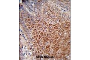 Formalin-fixed and paraffin-embedded human skin reacted with IGH Antibody (C-Term), which was peroxidase-conjugated to the secondary antibody, followed by DAB staining. (IgH anticorps  (C-Term))