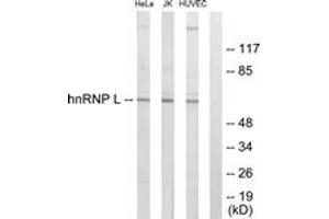 Western blot analysis of extracts from HeLa/Jurkat/HuvEc cells, using hnRNP L Antibody. (HNRNPL anticorps  (AA 61-110))