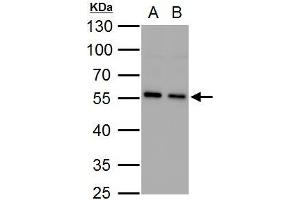 WB Image SQSTM1 antibody [N3C1], Internal detects SQSTM1 protein by western blot analysis. (SQSTM1 anticorps)