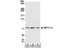 anti-Methyltransferase Like 13 (METTL13) (AA 650-700) antibody