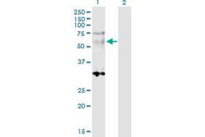 Western Blot analysis of SGCE expression in transfected 293T cell line by SGCE MaxPab polyclonal antibody. (SGCE anticorps  (AA 1-437))
