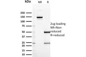 SDS-PAGE Analysis Purified CD127 Mouse Monoclonal Antibody (IL7R/2751). (IL7R anticorps  (AA 21-236))