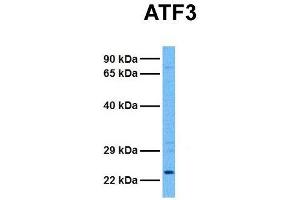 Host:  Rabbit  Target Name:  ATF3  Sample Tissue:  Human 293T  Antibody Dilution:  1. (ATF3 anticorps  (Middle Region))