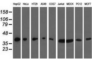 Western blot analysis of extracts (35 µg) from 9 different cell lines by using anti-HIBCH monoclonal antibody.