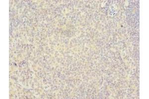 Immunohistochemistry of paraffin-embedded human tonsil tissue using ABIN7167369 at dilution of 1:100 (RAB6B anticorps  (AA 2-208))