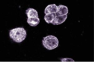 Pax-5 staining on paraformaldehyde-fixed SW-13 cells. (PAX5 anticorps  (AA 151-306))