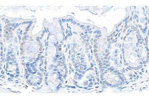 Immunohistochemistry (IHC) image for anti-Glyceraldehyde-3-Phosphate Dehydrogenase (GAPDH) (AA 150-200) antibody (ABIN7454519)