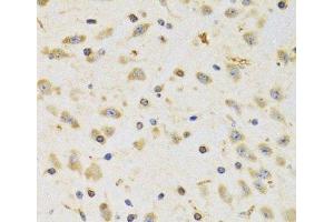 Immunohistochemistry of paraffin-embedded Rat brain using RPS12 Polyclonal Antibody at dilution of 1:100 (40x lens). (RPS12 anticorps)
