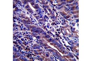 MUC-1 antibody immunohistochemistry analysis in formalin fixed and paraffin embedded human stomach tissue.