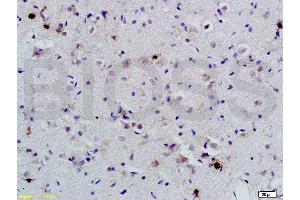 Formalin-fixed and paraffin-embedded rat brain labeled with Anti-BNP Polyclonal Antibody, Unconjugated (ABIN678623) 1:200, overnight at 4 °C, The secondary antibody was Goat Anti-Rabbit IgG, Cy3 conjugated used at 1:200 dilution for 40 minutes at 37 °C. (BNP anticorps  (AA 85-115))