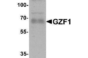 Western blot analysis of GZF1 in human heart tissue lysate with GZF1 antibody at 1 µg/mL. (ZNF336 anticorps  (C-Term))