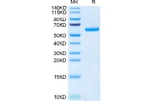 Human TNFRSF11A on Tris-Bis PAGE under reduced condition. (TNFRSF11A Protein (AA 30-212) (Fc Tag))