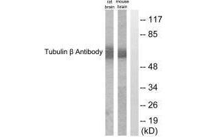 Western blot analysis of extracts from rat cells and mouse brain cells, using Tubulin β antibody. (TUBB3 anticorps  (C-Term))