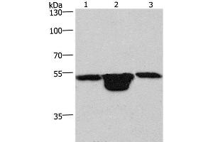 Western Blot analysis of Hela cell, Mouse muscle and kidney tissue using PLEKHO1 Polyclonal Antibody at dilution of 1:200 (PLEKHO1 anticorps)