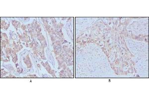 Immunohistochemical analysis of paraffin-embedded human breast cancer,Lung breast tissues using EGF mouse mAb