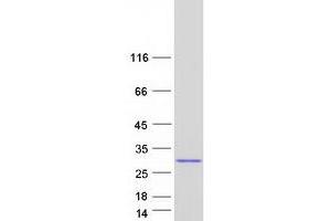 Validation with Western Blot