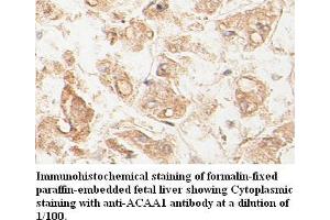 Image no. 1 for anti-Acetyl-CoA Acyltransferase 1 (ACAA1) antibody (ABIN791175) (ACAA1 anticorps)
