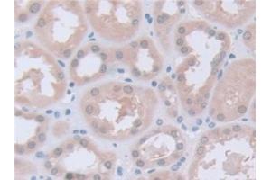 Detection of PGM1 in Human Kidney Tissue using Polyclonal Antibody to Phosphoglucomutase 1 (PGM1)