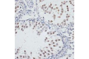 Immunohistochemistry of paraffin-embedded rat testis using NOL3 antibody.