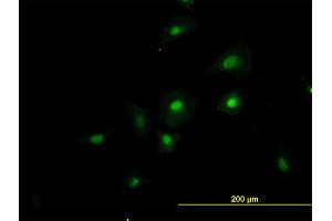 Immunofluorescence of monoclonal antibody to RNPC2 on HeLa cell.