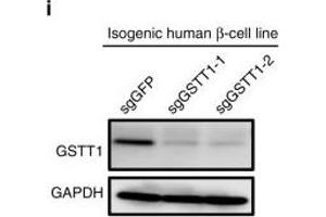 A hPSC-based population study discovers that GSTT1-null pancreatic β-like cells are hypersensitive to propargite-induced cell death.