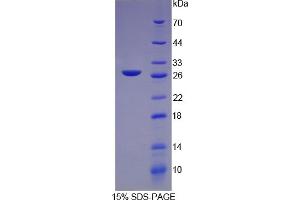 SDS-PAGE of Protein Standard from the Kit (Highly purified E.