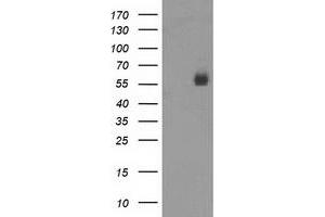 Western Blotting (WB) image for anti-Poliovirus Receptor-Related 1 (Herpesvirus Entry Mediator C) (PVRL1) antibody (ABIN1499678)