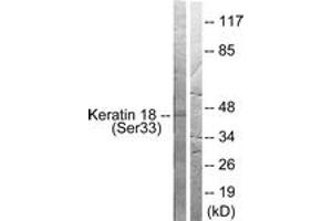 Western blot analysis of extracts from HT29 cells, using Keratin 18 (Phospho-Ser33) Antibody. (Cytokeratin 18 anticorps  (pSer34))