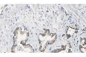 ABIN6275433 at 1/100 staining Human prostate tissue by IHC-P. (CHML anticorps  (Internal Region))