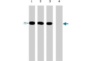Western blots of human PAK6 recombinant protein phosphorylated by ERK2. (PAK6 anticorps  (N-Term))
