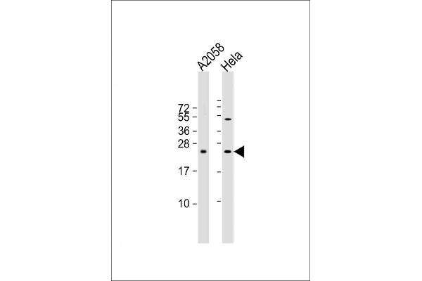 SDHD anticorps  (N-Term)
