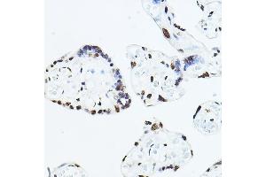 Immunohistochemistry of paraffin-embedded human placenta using TE Rabbit pAb (ABIN6129488, ABIN6148982, ABIN6148984 and ABIN6217332) at dilution of 1:100 (40x lens).