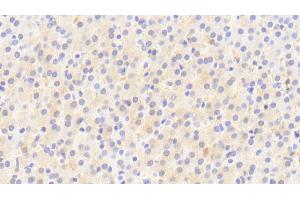 Detection of TJP2 in Human Liver Tissue using Polyclonal Antibody to Tight Junction Protein 2 (TJP2)