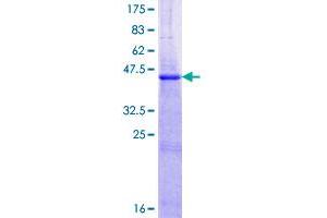 Image no. 1 for NADH Dehydrogenase (Ubiquinone) 1 beta Subcomplex, 5, 16kDa (NDUFB5) (AA 1-189) protein (GST tag) (ABIN1312257)