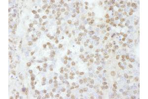 Immunohistochemistry (IHC) image for anti-RNA Binding Motif Protein 16 (RBM16) (C-Term) antibody (ABIN7448761) (RBM16 anticorps  (C-Term))