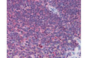 IHC Information: Paraffin embedded spleen tissue, tested with an antibody dilution of 5 ug/ml. (IFIH1 anticorps  (Middle Region))