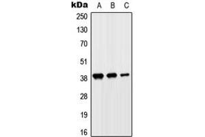 Western blot analysis of SLC10A7 expression in HeLa (A), HepG2 (B), H9C2 (C) whole cell lysates. (SLC10A7 anticorps  (Center))