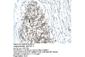 Human urinary bladder (MMP19 anticorps  (C-Term))
