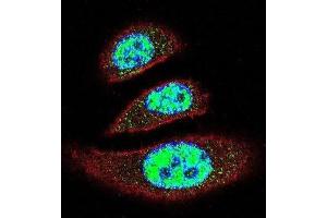 Immunofluorescence (IF) image for anti-tyrosyl-DNA phosphodiesterase 2 (TDP2) antibody (ABIN2996093) (TDP2 anticorps)
