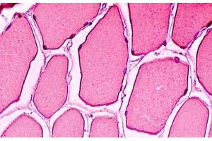 Human Skeletal Muscle: Formalin-Fixed, Paraffin-Embedded (FFPE) (Myoglobin anticorps)