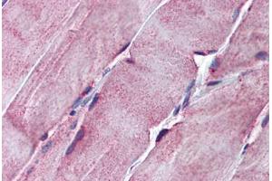 Human Skeletal Muscle: Formalin-Fixed, Paraffin-Embedded (FFPE)