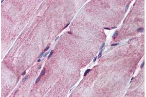 Human Skeletal Muscle: Formalin-Fixed, Paraffin-Embedded (FFPE) (SGCE anticorps  (AA 36-85))