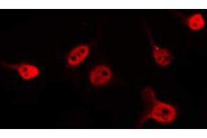 ABIN6274587 staining 293 by IF/ICC.