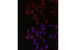 Immunofluorescence analysis of U2OS cells using YES1 Rabbit pAb (ABIN1683305, ABIN3015262, ABIN3015263 and ABIN6213907) at dilution of 1:250 (40x lens). (YES1 anticorps  (AA 1-250))