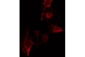 ABIN6275661 staining  COLO205 cells by IF/ICC. (YOD1 anticorps  (Internal Region))