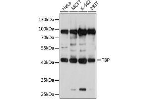 Western blot analysis of extracts of various cell lines, using TBP antibody (ABIN3023174, ABIN3023175, ABIN3023176 and ABIN1513589) at 1:1000 dilution. (TBP anticorps  (AA 1-100))